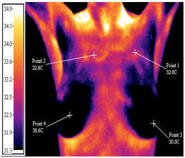 PET, CT Scans, and Thermagraphy for Breast Cancer Imaging